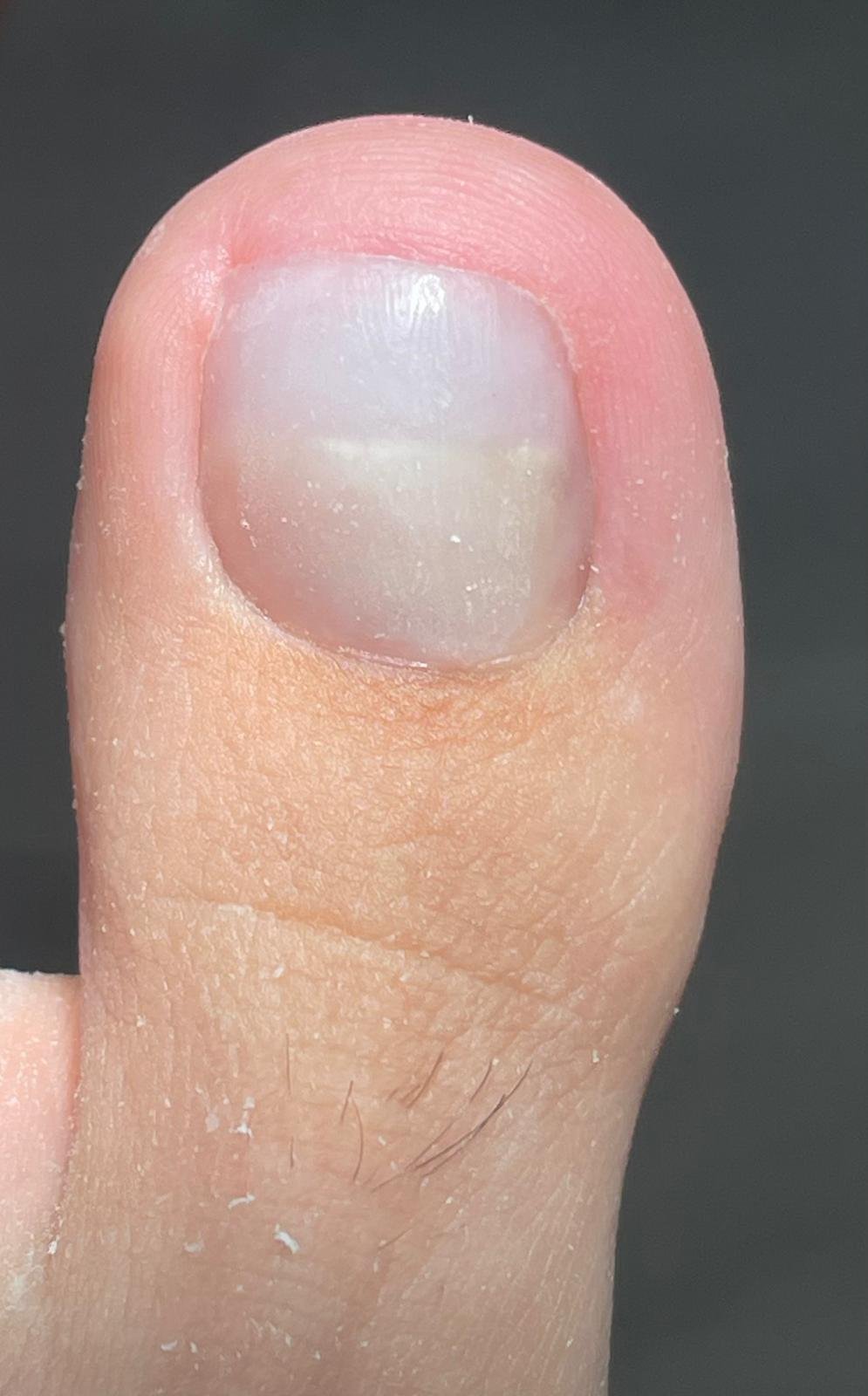 Podología estética