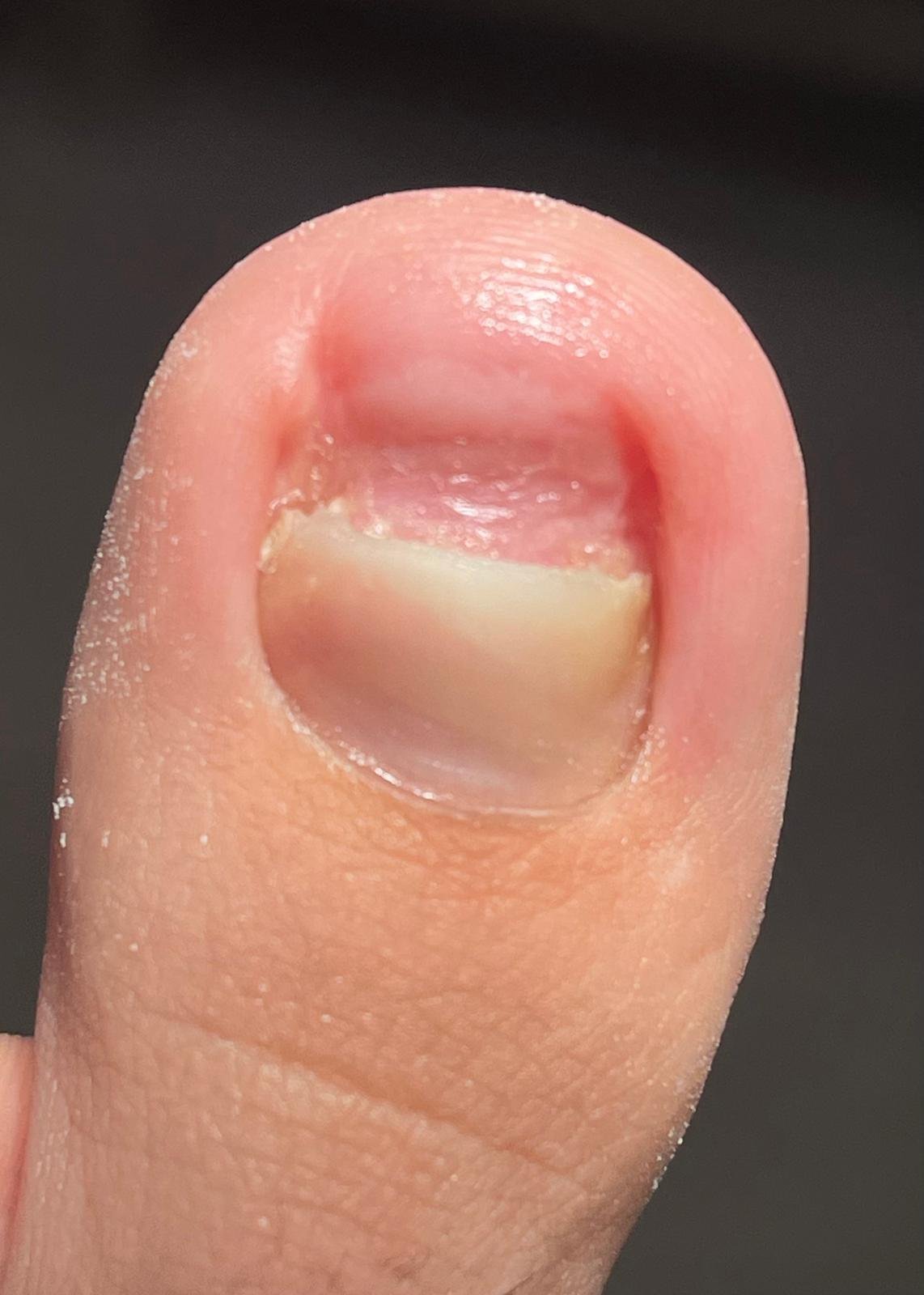 Podología estética